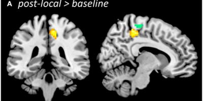 feldenkrais wissenschaftliche studien changes in neural resting state