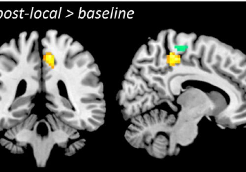 feldenkrais wissenschaftliche studien changes in neural resting state