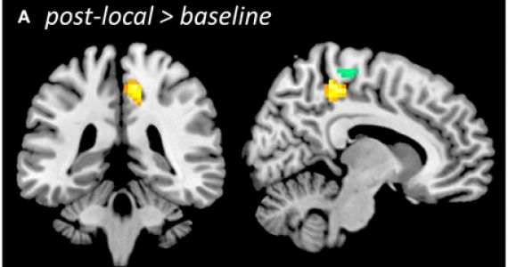 feldenkrais wissenschaftliche studien changes in neural resting state